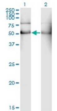 Monoclonal Anti-ALDH2 antibody produced in