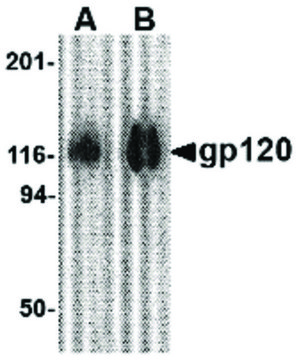 Anti-GP120 antibody produced in rabbit
