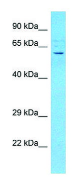 Anti-ACVR2B (C-terminal) antibody produced in