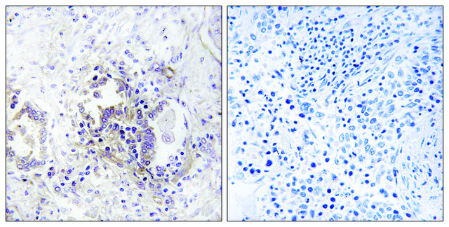 Anti-CHML antibody produced in rabbit