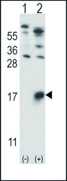 ANTI-GYPB (CENTER) antibody produced in