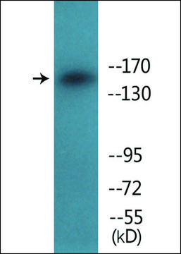 Anti-phospho-IGF1R (pTyr¹¹?¹) antibody produced in