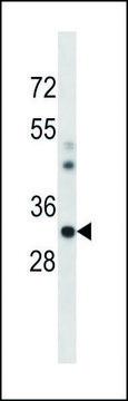 ANTI-MOUSE CSNK1A1 (C-TERM) antibody produced