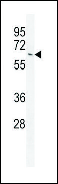 ANTI-NKPD1(C-TERMINAL) antibody produced in rabbit
