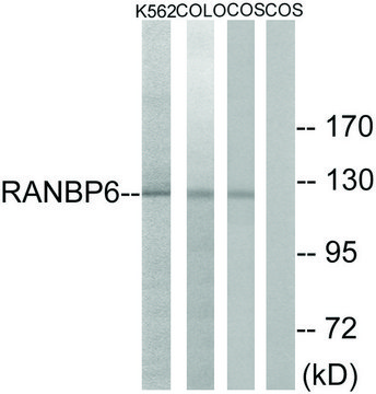 Anti-RANBP6 antibody produced in rabbit