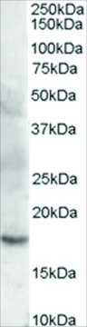 Anti-Cofilin 2 (muscle) antibody produced