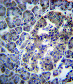 ANTI-DNAJC14 (CENTER) antibody produced in