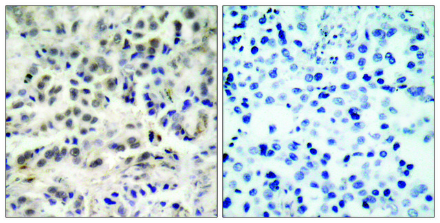 Anti-p27 KIP1 antibody produced in