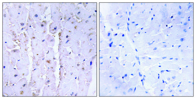 Anti-AKAP13 antibody produced in rabbit