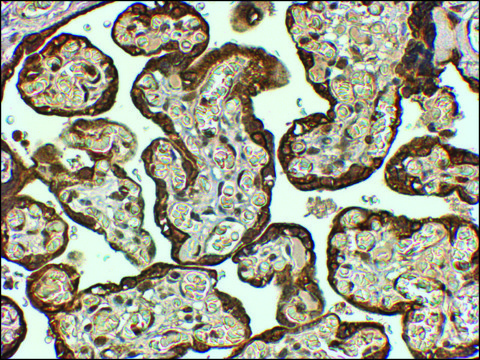 Anti-PAI1/SERPINE1 antibody produced in goat