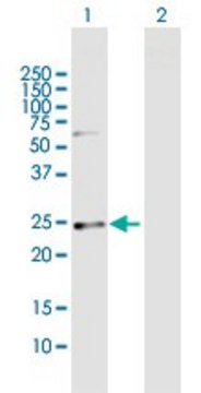 Anti-CSN1S1 antibody produced in mouse