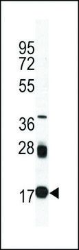 MONOCLONAL ANTI-UBC9 antibody produced in