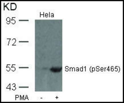 Anti-phospho-SMAD1 (pSer???) antibody produced in