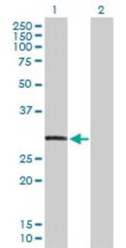 Anti-CAPZA3 antibody produced in rabbit