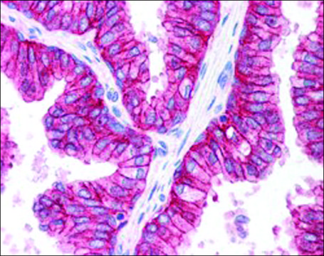 Anti-ABCC4/MRP4 antibody produced in goat