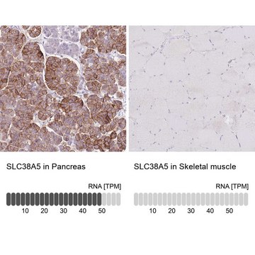 Anti-SLC38A5 antibody produced in rabbit