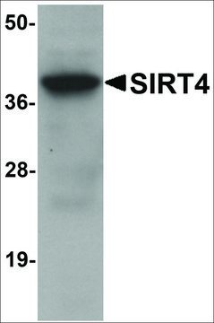 Anti-SIRT4 antibody produced in chicken