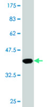 Monoclonal Anti-GBA antibody produced in