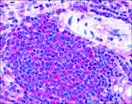 Anti-STS2/TULA (Internal) antibody produced in