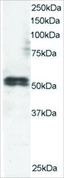 Anti-TFEB, N-Terminal antibody produced in