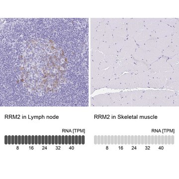 Anti-RRM2 antibody produced in rabbit