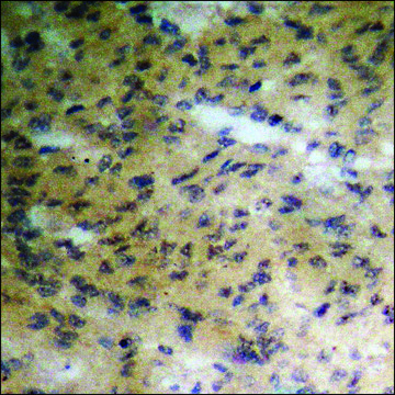 Anti-phospho-p90 RSK (pThr??³) antibody produced