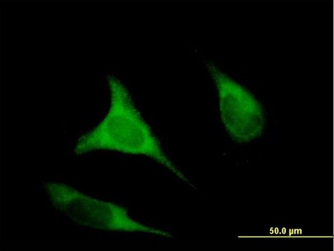 Anti-EIF2B3 antibody produced in mouse