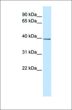 Anti-SETD3 antibody produced in rabbit