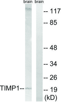 Anti-TIMP1 antibody produced in rabbit