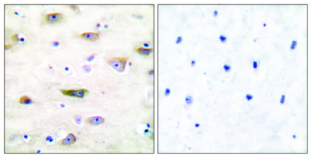 Anti-GLUR2 antibody produced in rabbit