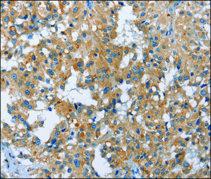 Anti-FGF9 antibody produced in rabbit