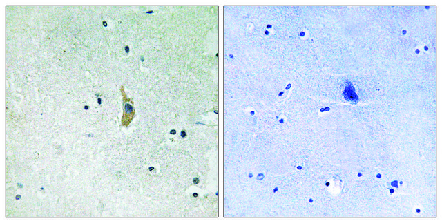 Anti-PSEN1 antibody produced in rabbit