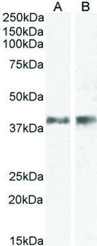 Anti-IL12B/IL12P40 (AB2) antibody produced in