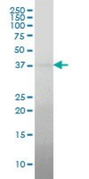 Monoclonal Anti-RCN2 antibody produced in