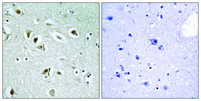 Anti-CDKA2 antibody produced in rabbit