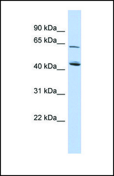 Anti-C5ORF33 antibody produced in rabbit