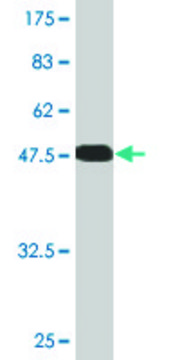Monoclonal Anti-RBJ antibody produced in