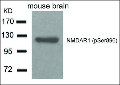 Anti-phospho-GRIN1 (pSer???) antibody produced in
