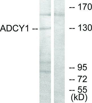 Anti-ADCY1 antibody produced in rabbit