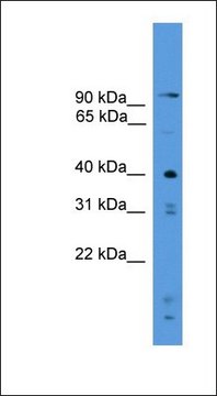 Anti-PRSS23 antibody produced in rabbit