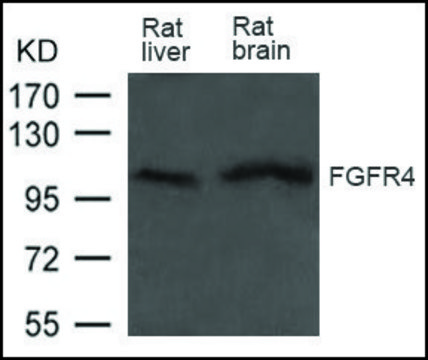 Anti-FGFR4 antibody produced in rabbit
