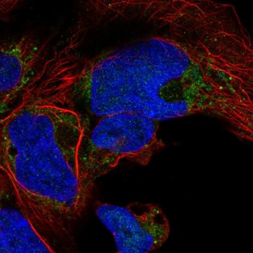 Anti-NDUFA10 antibody produced in rabbit