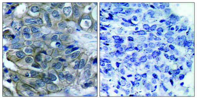 Anti-HER2 antibody produced in rabbit