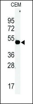 Anti-HIBCH (C-term) antibody produced in