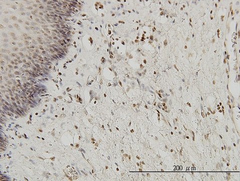 Monoclonal Anti-HYI antibody produced in