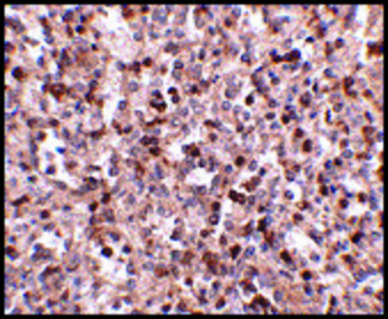 Anti-KLRA1 (ab1) antibody produced in