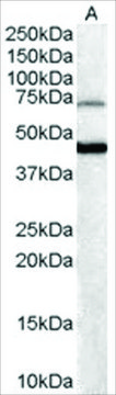 Anti-FOXG1A (BF2) and FOXG1B (BF1)