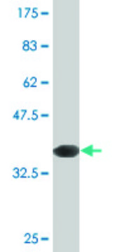 Monoclonal Anti-INPPL1, (C-terminal) antibody produced