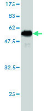 Monoclonal Anti-DC-UBP antibody produced in