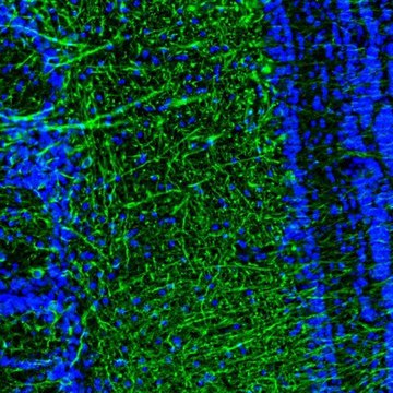 Anti-DPP6 antibody produced in rabbit